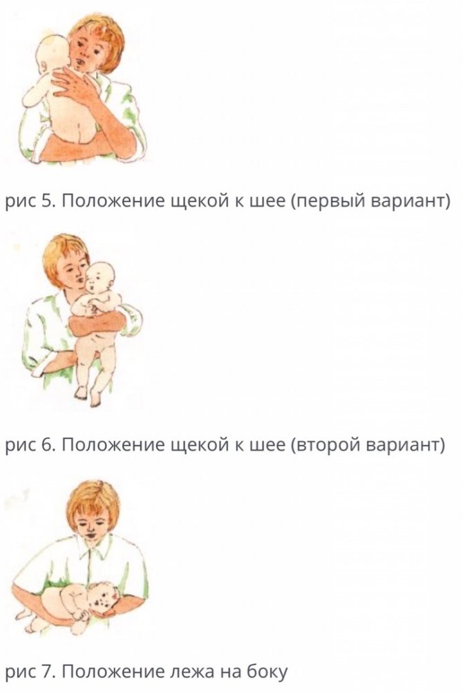 Кривошея у новорожденных: признаки у грудничка в 3 месяца, как исправить, основные симптомы