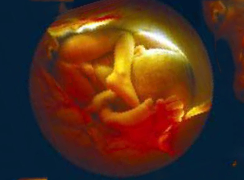 32 неделя беременности что происходит с мамой. Эмбрион 33 недели беременности. Ребенок в утробе на 33 неделе беременности. 33 Недели беременности фото плода. Малыш в 33 недели беременности в животе.