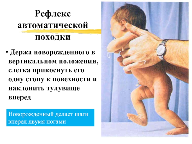 Рефлексы новорожденных презентация