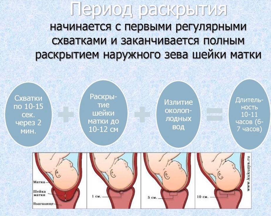 ➤ предвестники родов у повторнородящих