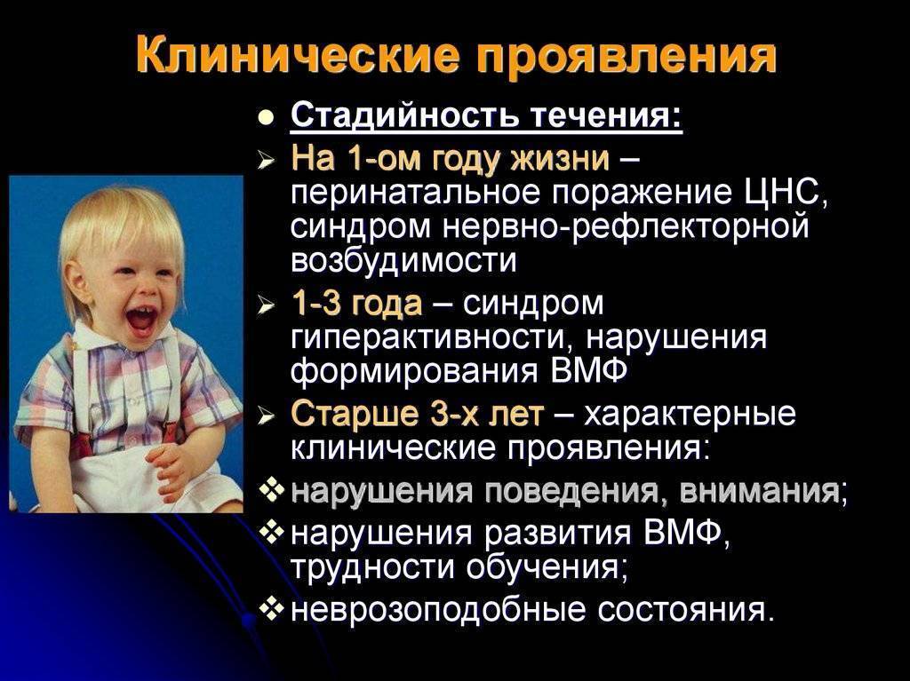 Поражение мозга у новорожденных. Клинические симптомы перинатальной патологии ЦНС. Поражение нервной системы у детей. Поражение ЦНС симптомы у детей.