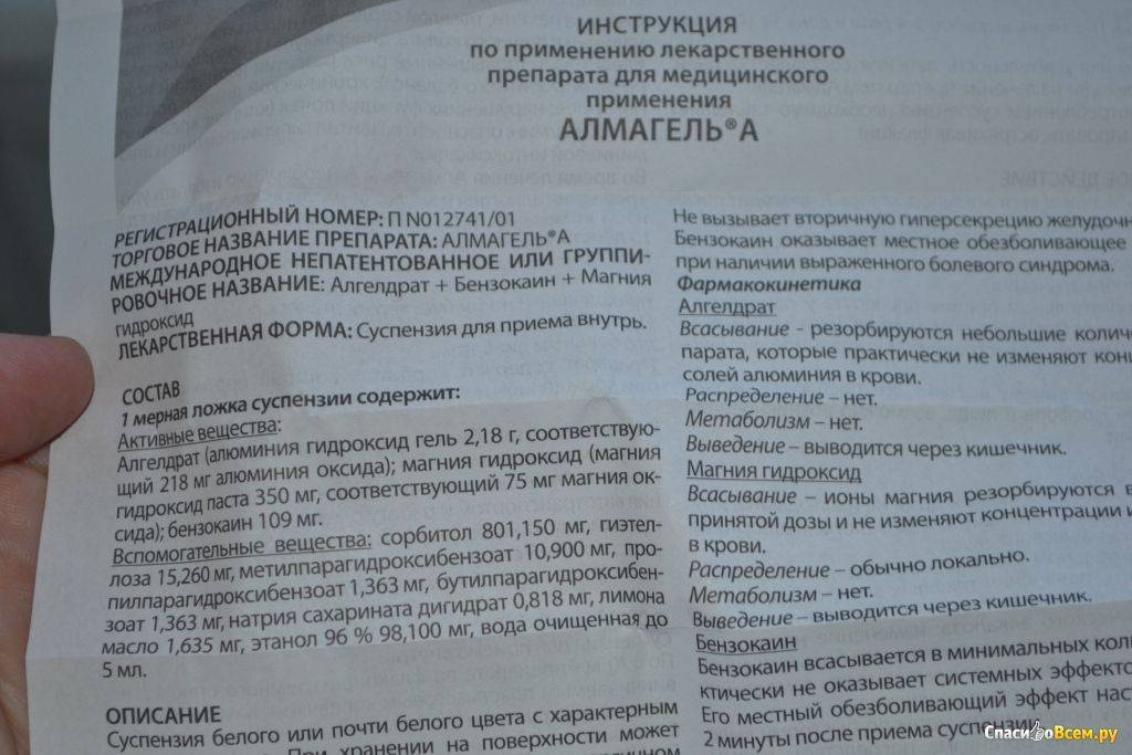 Гастрит