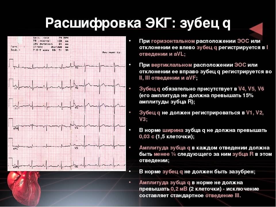 Экг ребенку: расшифровка, норма в таблице, нарушения работы сердца на кардиограмме