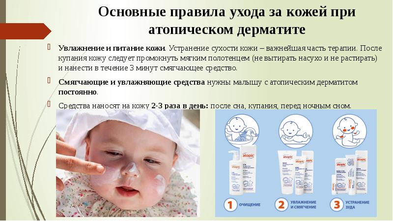 Аллергия у детей - как проявляется, чем лечат
