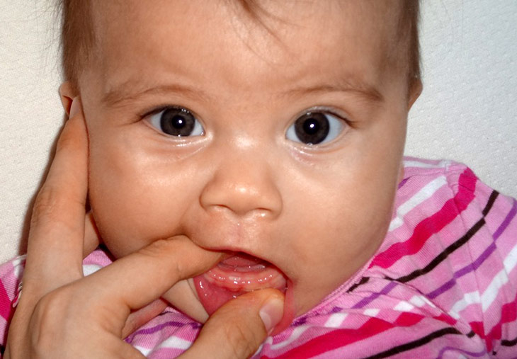 Почему у новорожденных слюни. Десна при прорезывании зубов у ребенка. Прорезывание зубов у детей симптомы.