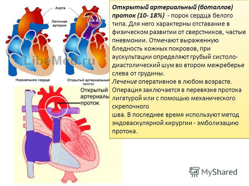 Диагностика и лечение врожденных пороков сердца в клиническом госпитале на яузе