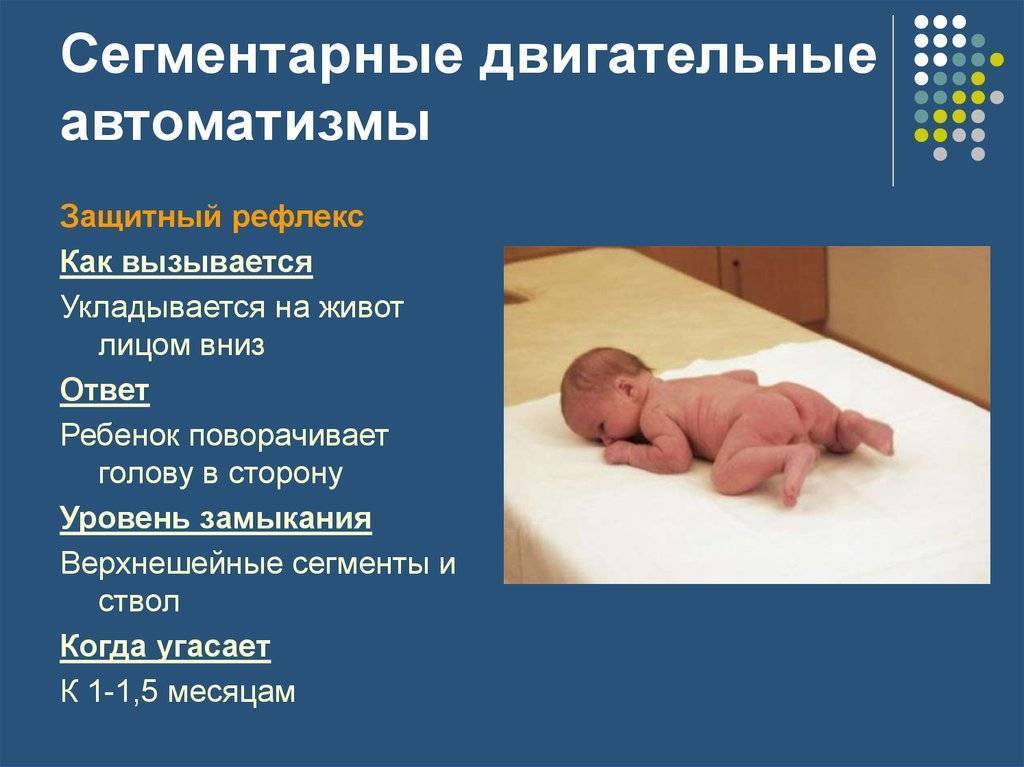 Эффект моро у младенцев до какого возраста - детская городская поликлиника №1 г. магнитогорска