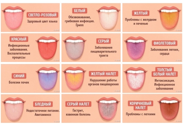 Скарлатина у детей – этапы болезни, классификация видов, протекание заболевания | см-клиника