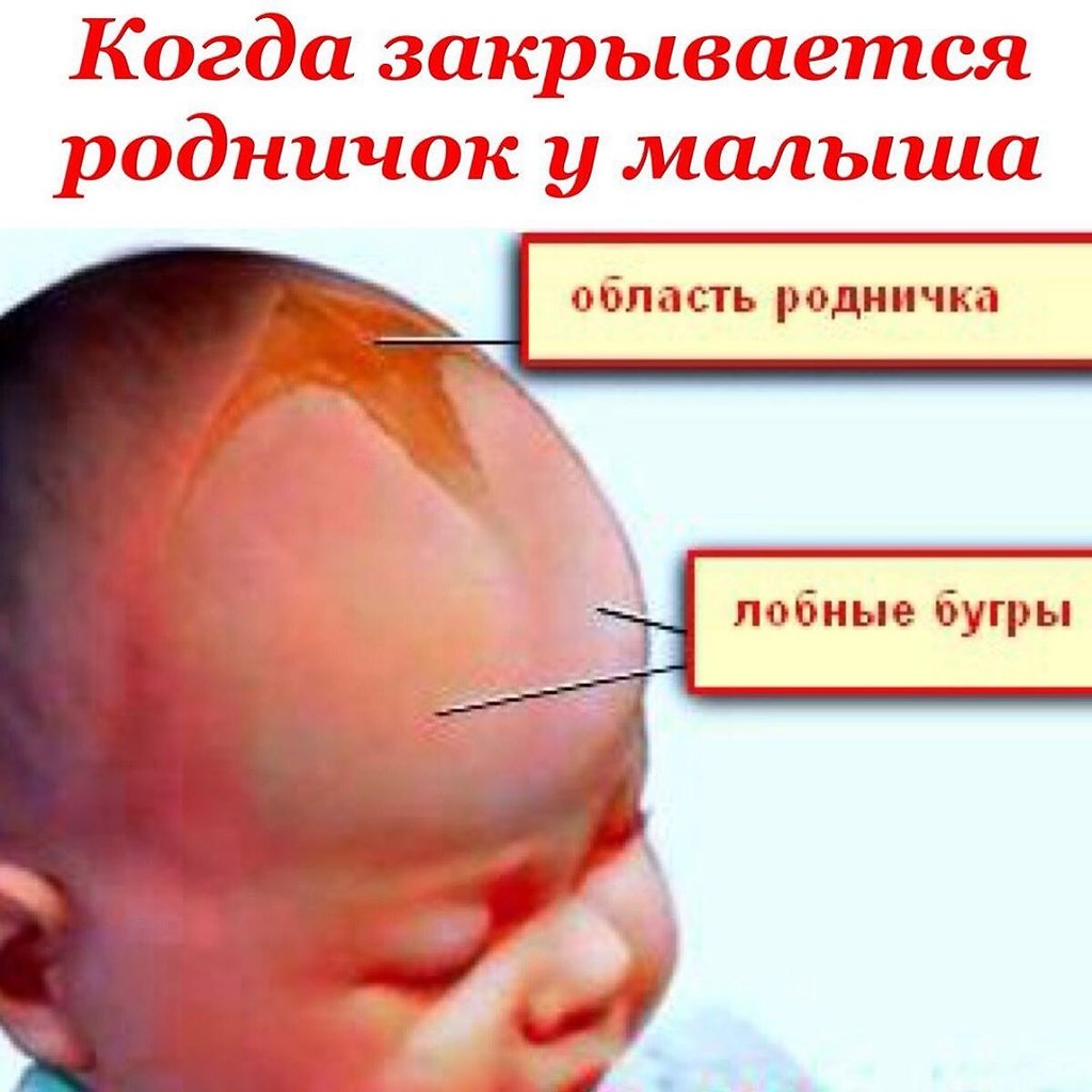 Когда зарастает родничок у новорожденного. когда зарастает родничок у младенцев :: syl.ru