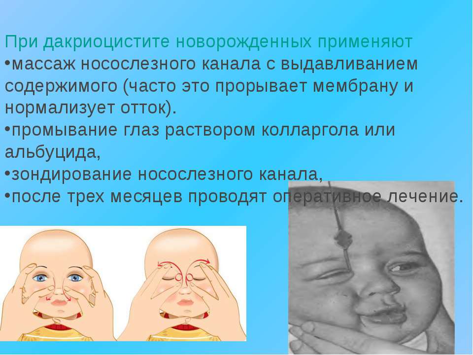 Советы для мам: что делать, если гноится глазик у новорожденного