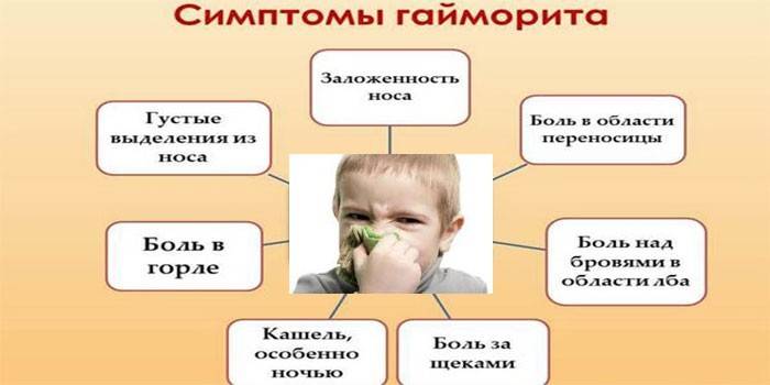 7 основных симптомов, которые говорят о гайморите у ребенка
