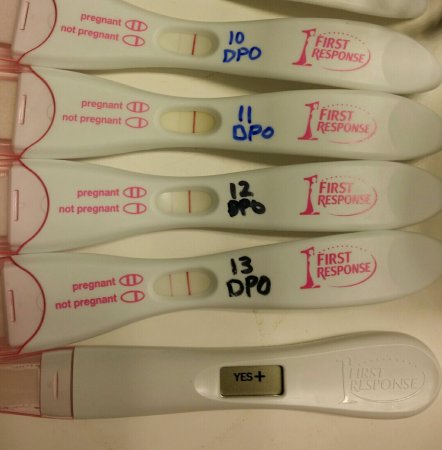 Выделения на ранних сроках беременности :: polismed.com