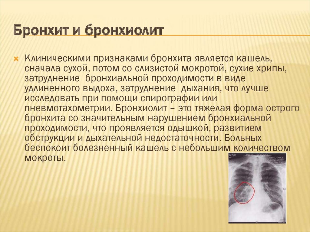Обструктивный бронхит у детей: что это такое, причины возникновения, роль психосоматики, симптомы, как протекает у грудничка, клинические рекомендации по лечению