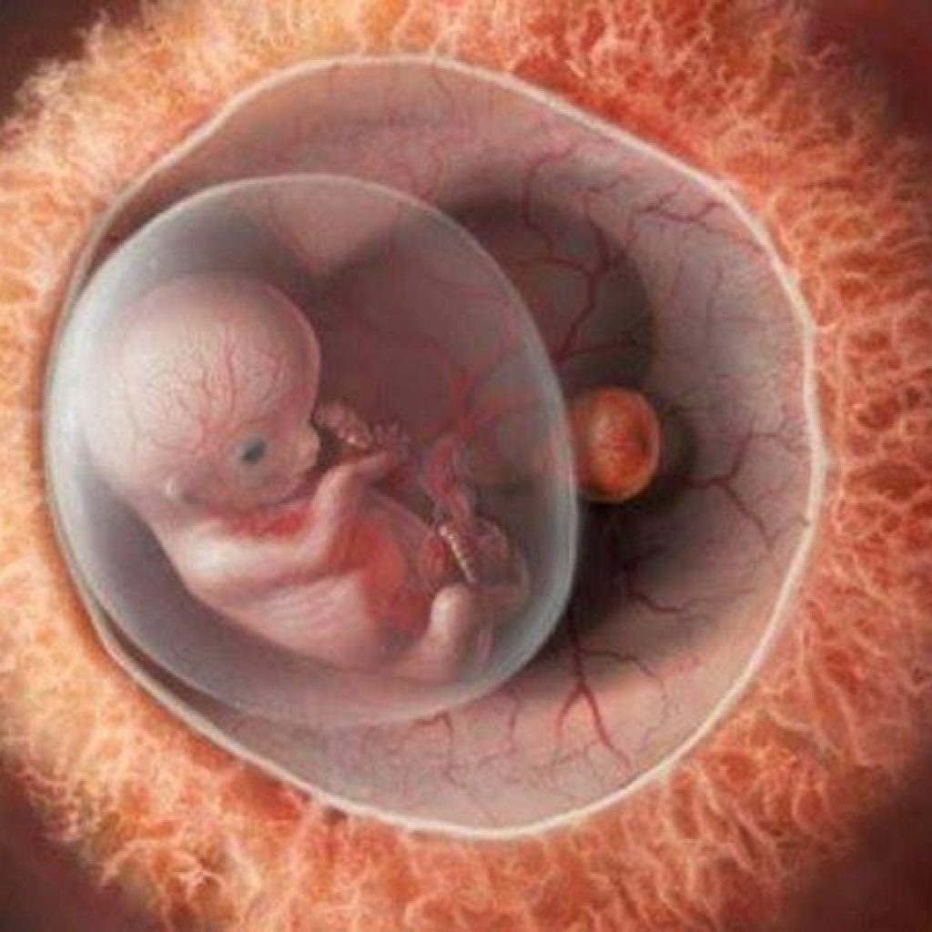Тошнота 10 недель. Эмбрион на 10 неделе беременности. Плод на 10 неделе беременности.