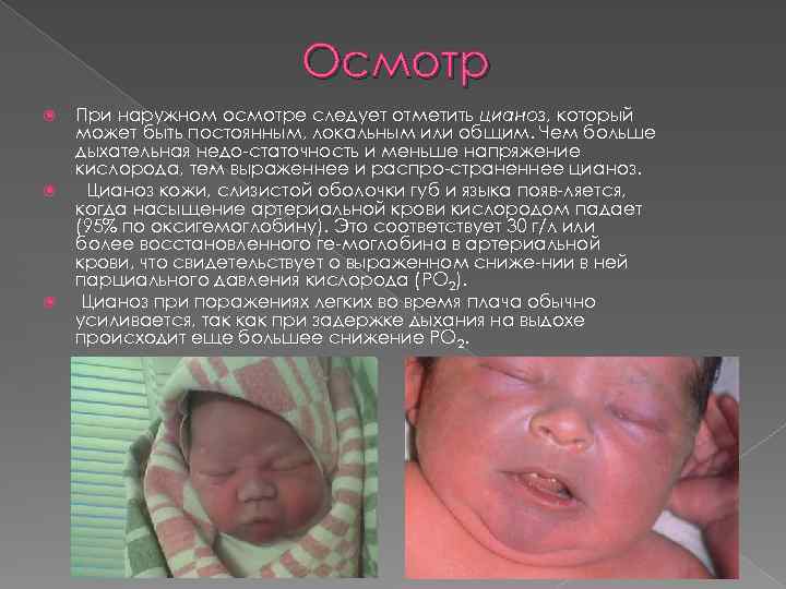 Цианоз | симптомы | диагностика | лечение - docdoc.ru