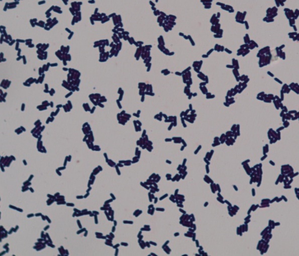 Йодофильная флора в кале у ребенка, патологические бактерии в копрограмме: что это значит?