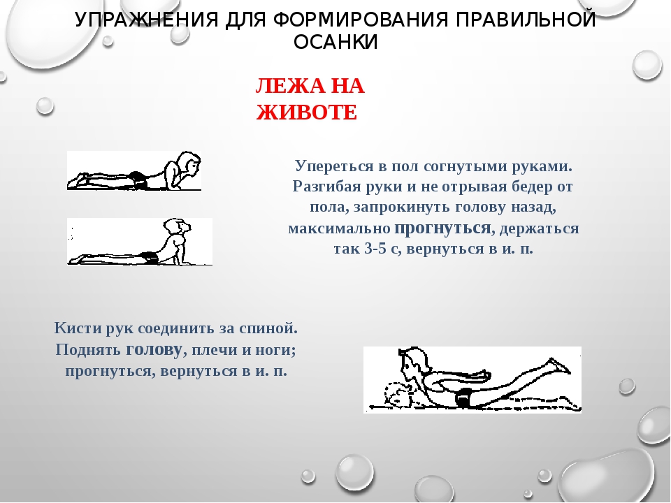 Нарушение осанки у детей