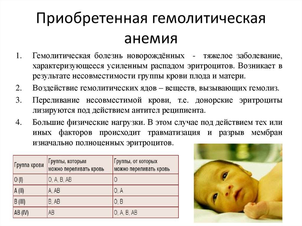 Гемангиома у новорожденных: лечение пропранололом