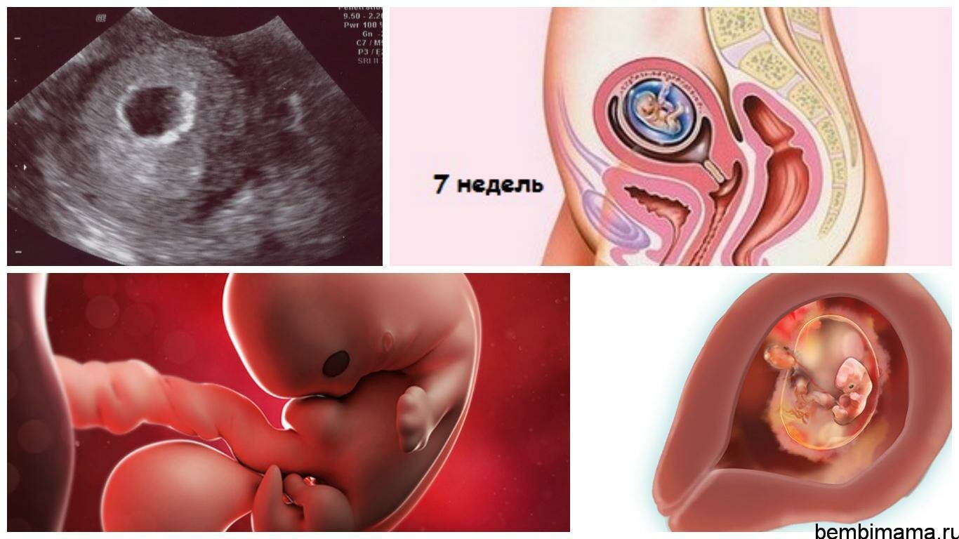 Изменения и развитие эмбриона на 7-й неделе беременности