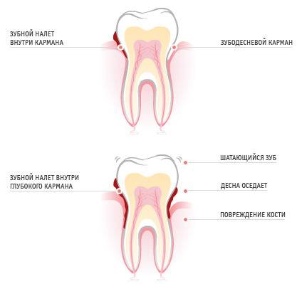 Лечение подвижных зубов у детей