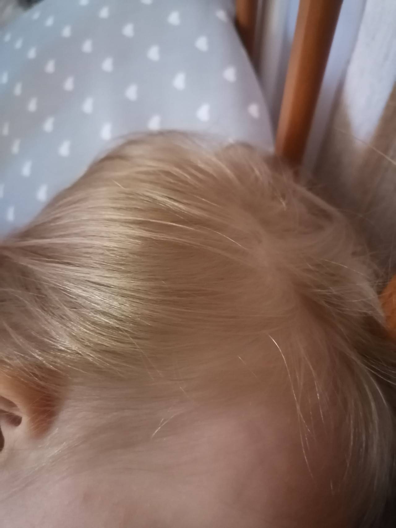 Медленно растут волосы у ребенка: причины и что делать?