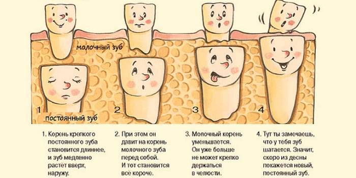 Выпадение молочных зубов