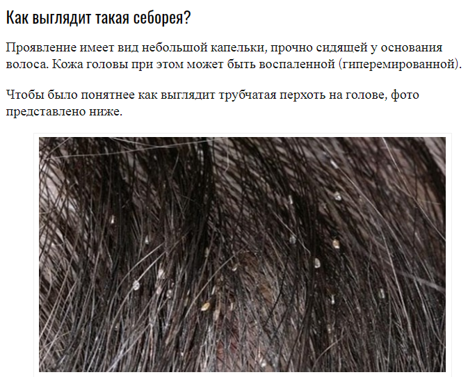 Что такое чешуйки волоса человека