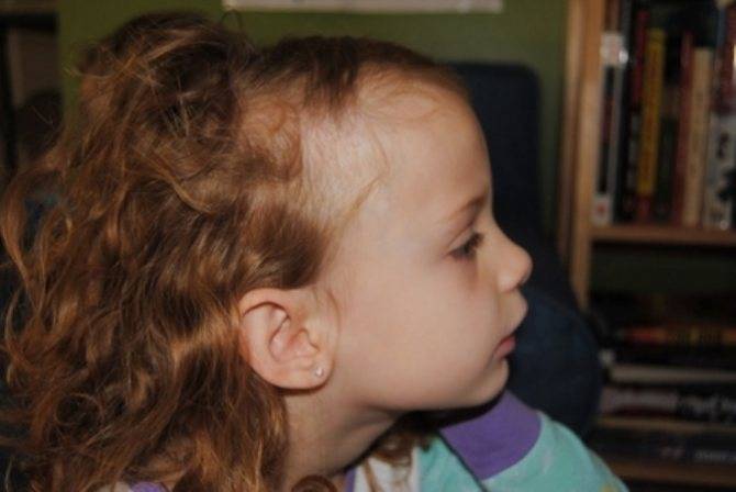 Медленно растут волосы у ребенка — 5 причин этого явления