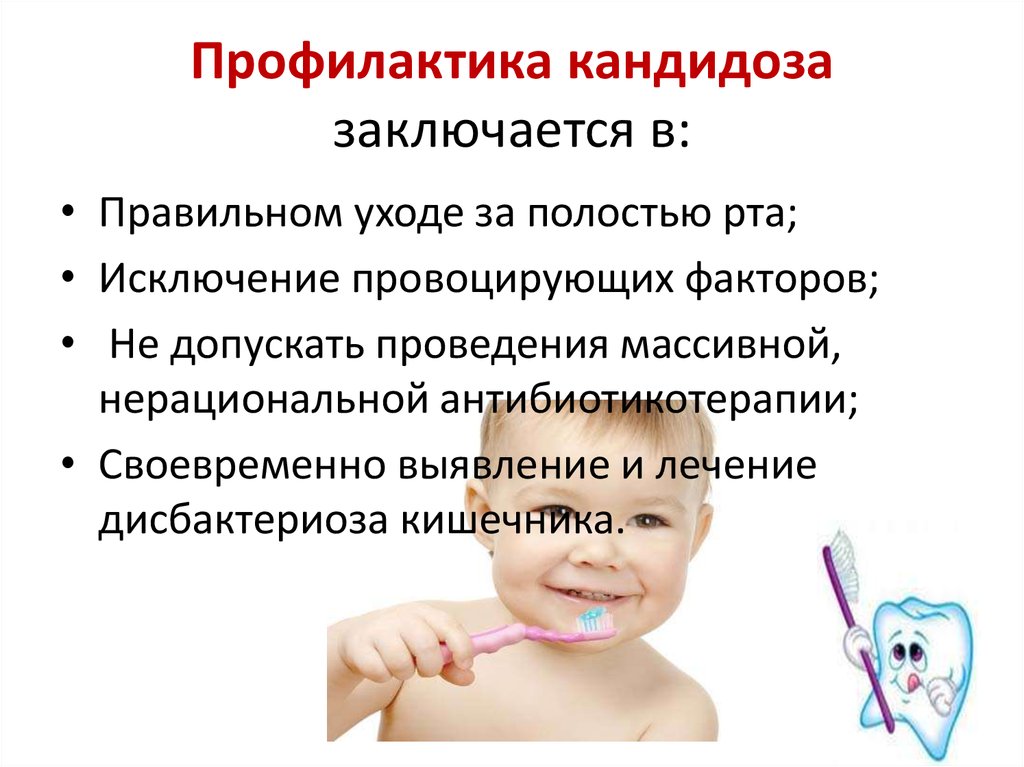 Молочница у детей (+ фото)