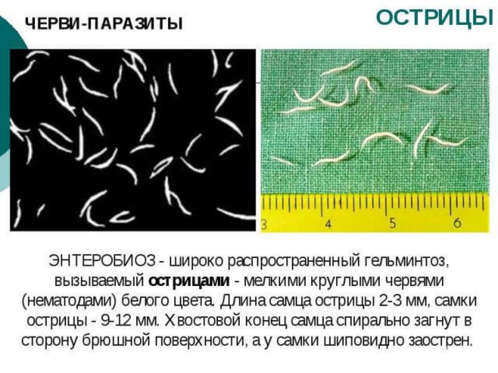 Признаки заражения глистами | университетская клиника