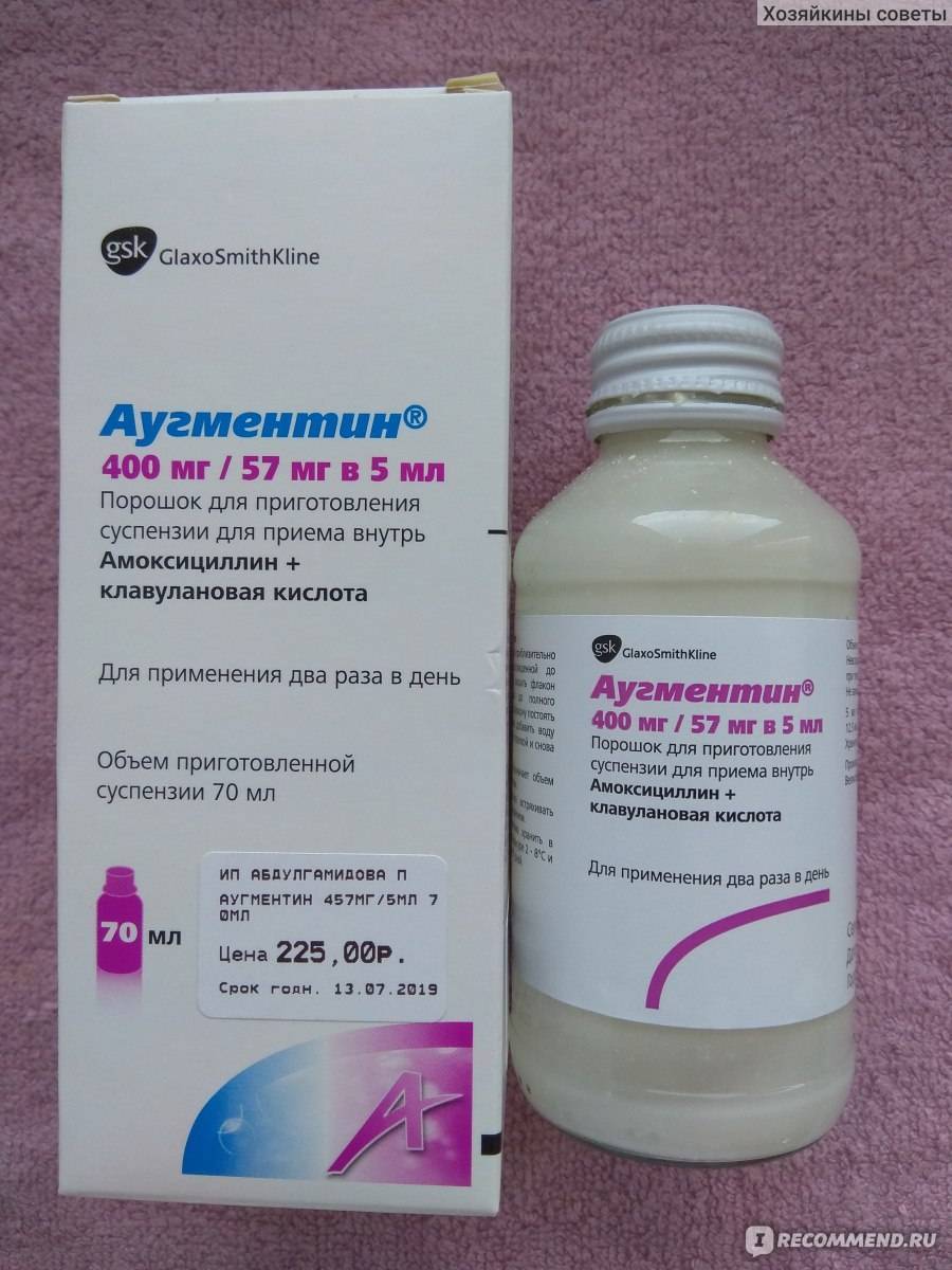 Острый средний отит у детей: симптомы и лечение