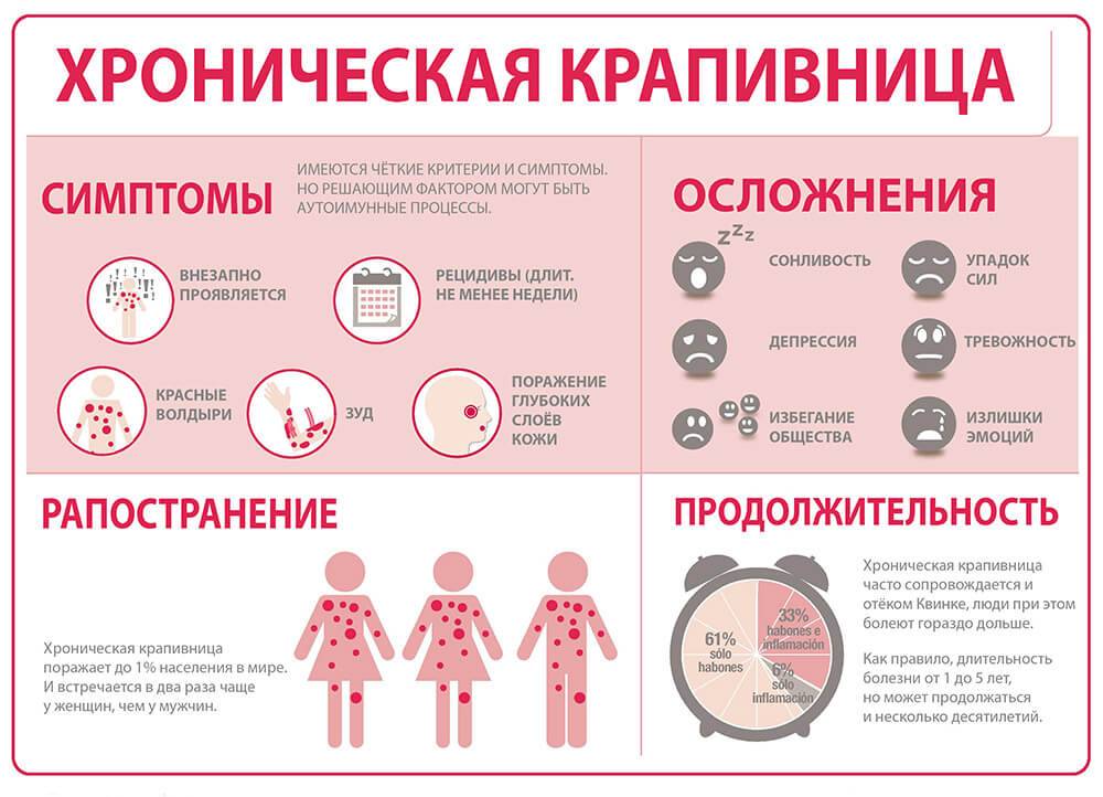 Крапивница: фото, симптомы и лечение у взрослых