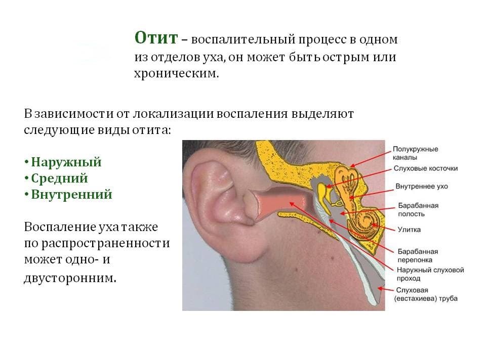 Отит уха у взрослого: симптомы и лечение, наружный, внутренний, средний.