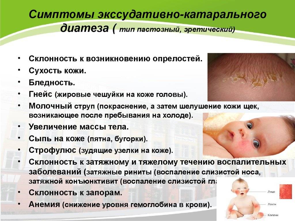 Кожа малыша: банальное раздражение или грибковая инфекция? - педиатрия | добро пожаловать в «клинику айгерим»