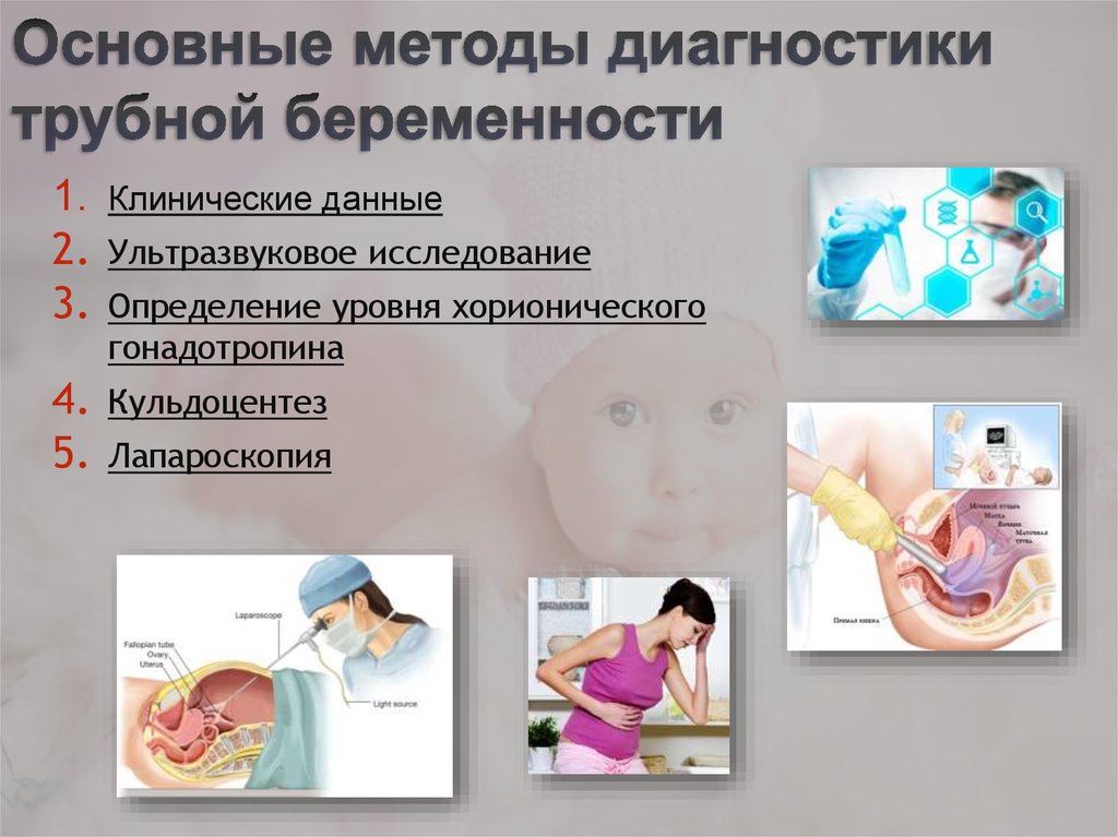 Внематочная беременность. причины, симптомы, диагностика и лечение