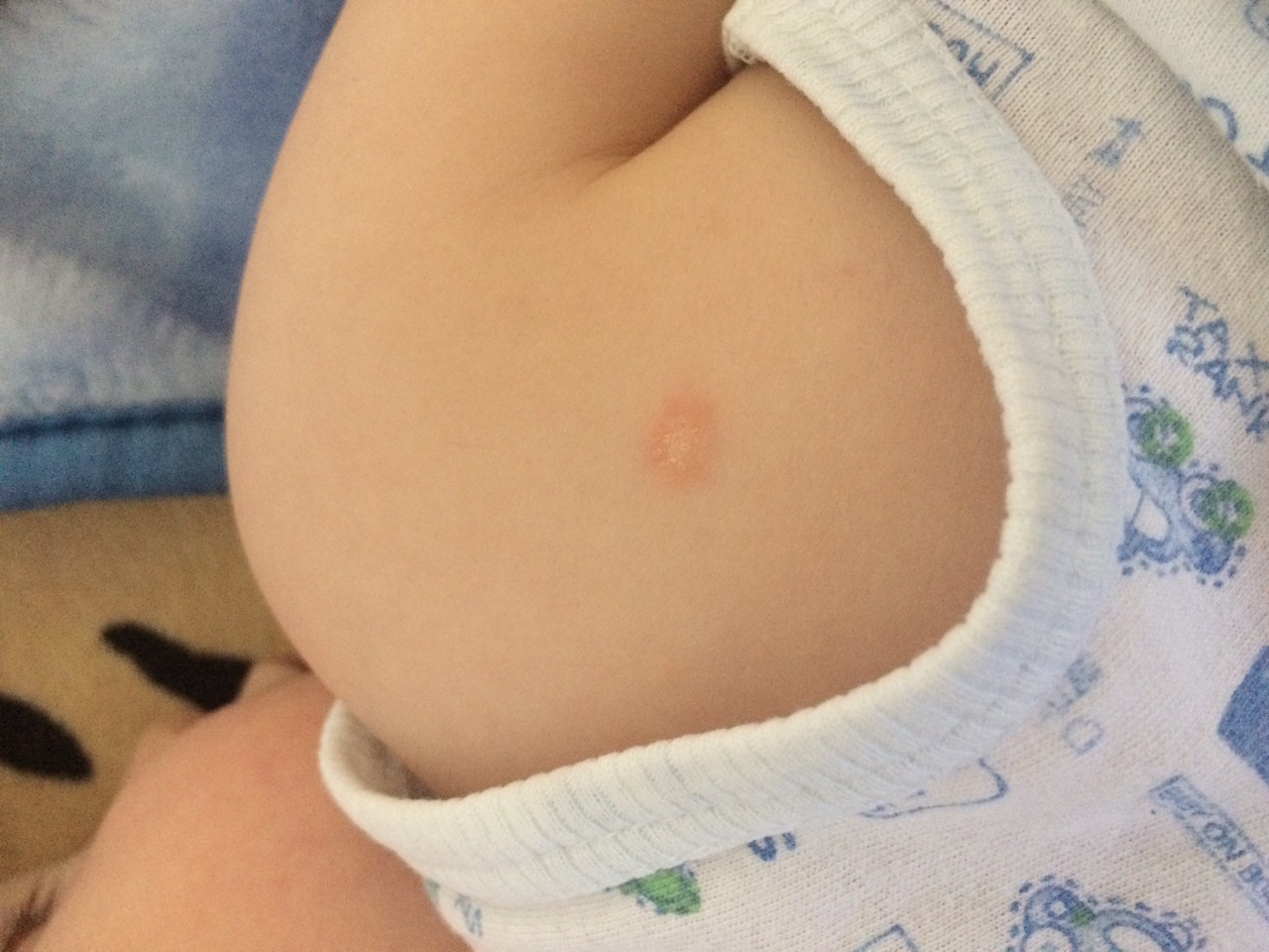 аллергия на груди у беременной фото 52