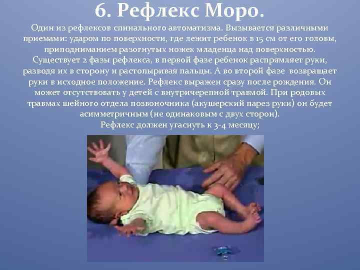 Рефлексы бабинского, галанта, бабкина и моро у новорожденного и таблица по месяцам