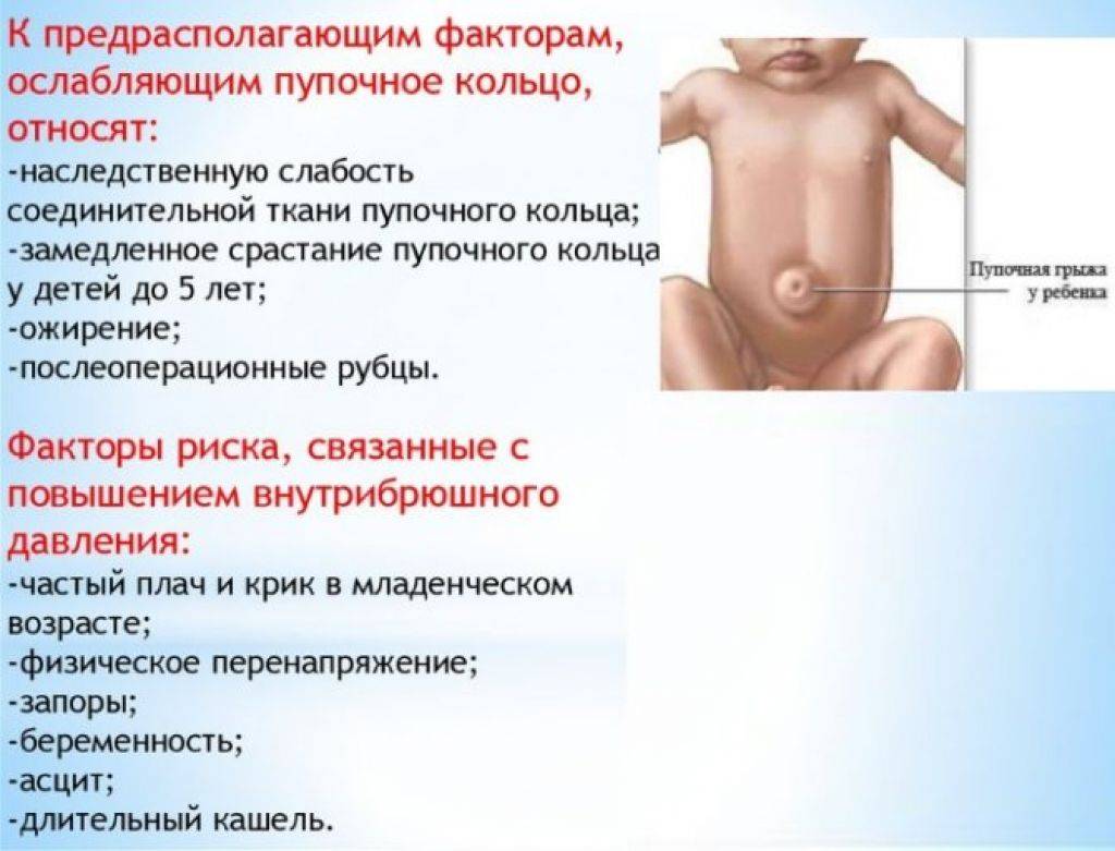 Пупочная грыжа у новорождённых: симптомы, фото и лечение
