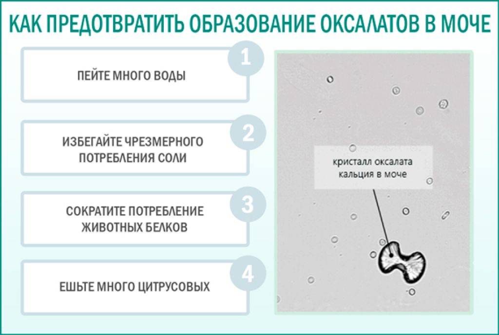 Кристаллурия. причины, симптомы и лечение кристалллурии