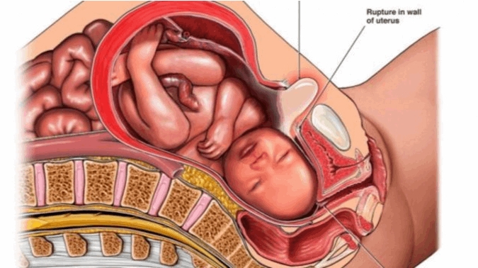 Кишечник и матка при беременности фото