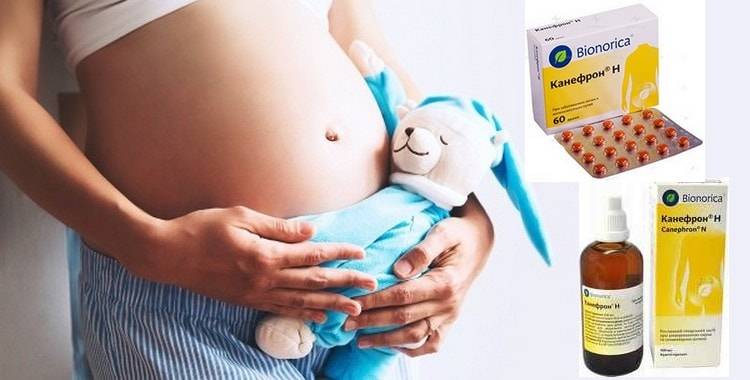 Канефрон или натуральные средства при беременности: что выбрать?