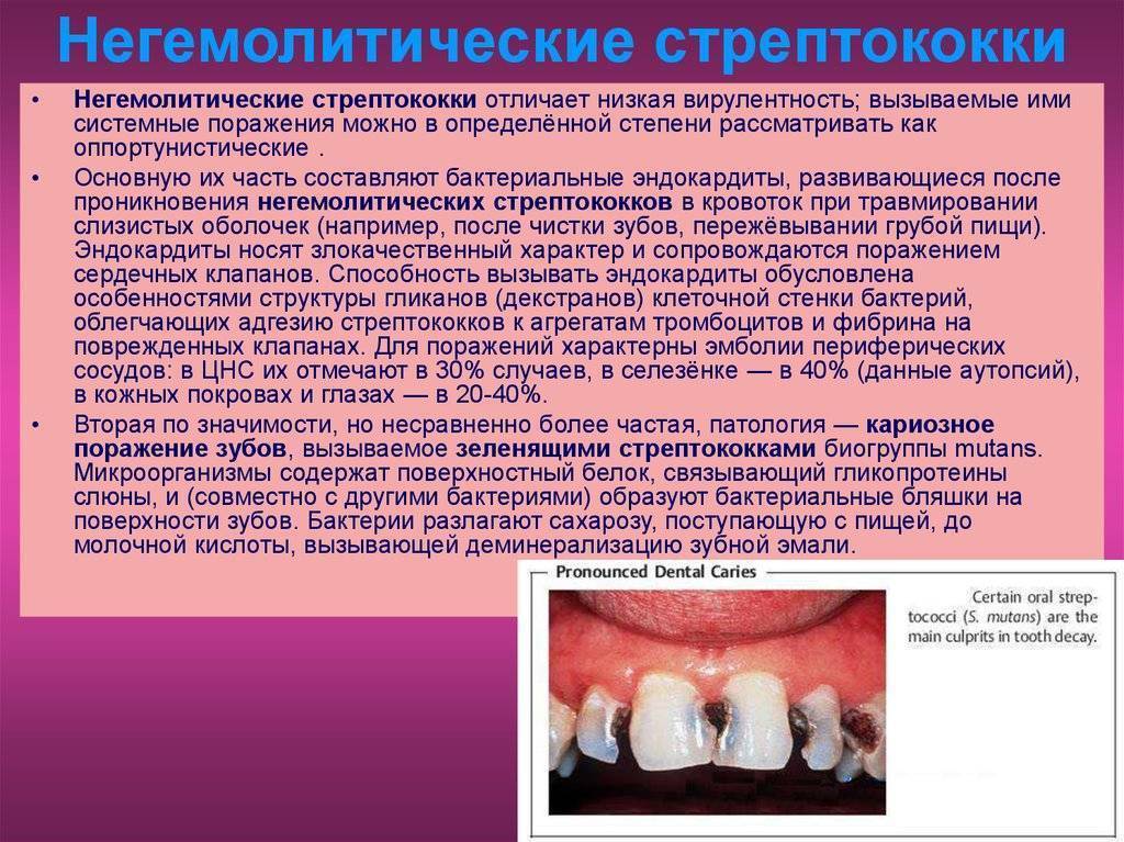 Стрептококк в горле симптомы и лечение | подольская городская детская поликлиника № 3
