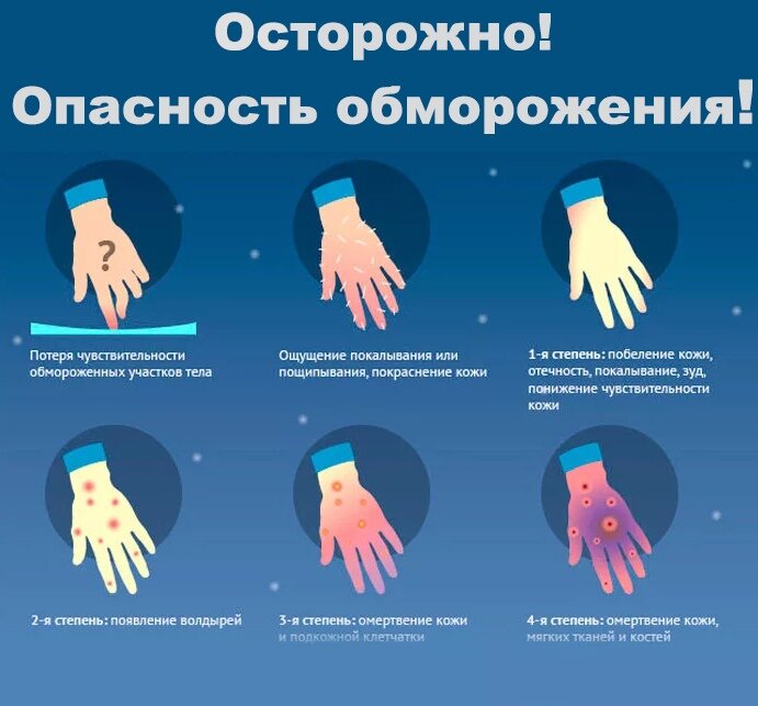 Первая помощь при обморожении рук, ног, пальцев, лица у ребёнка, симптомы, степени