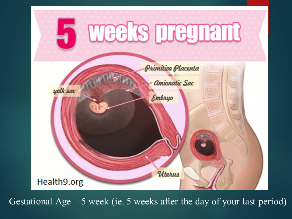 5 неделя беременности