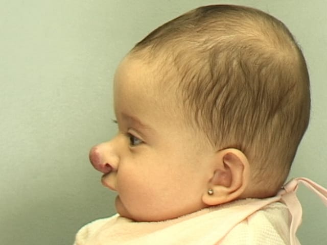 Волосы на ушах новорожденного | уроки для мам