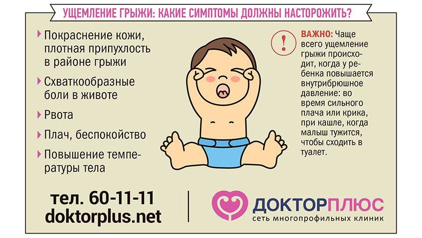 Лечение пупочной грыжи у новорожденного малыша