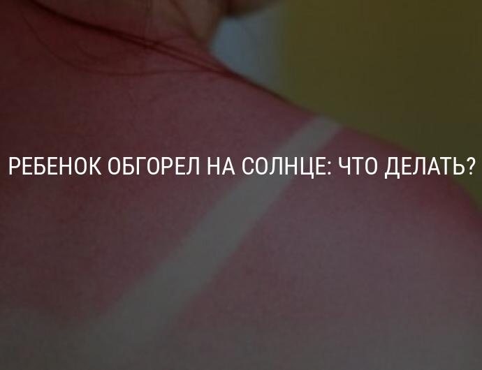 Грудничок сгорел на солнце: что делать