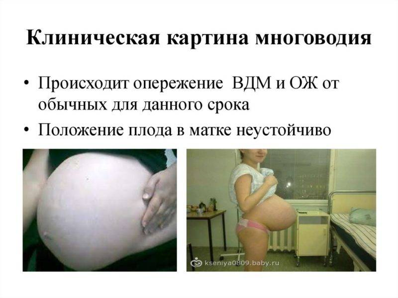 Осложнения беременности (развития плода) | eurolab | гинекология