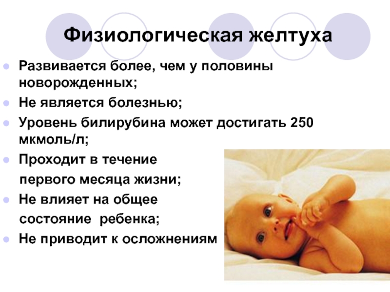 Желтуха новорождённых - статьи - клиника «c нуля» (здоровая семья)