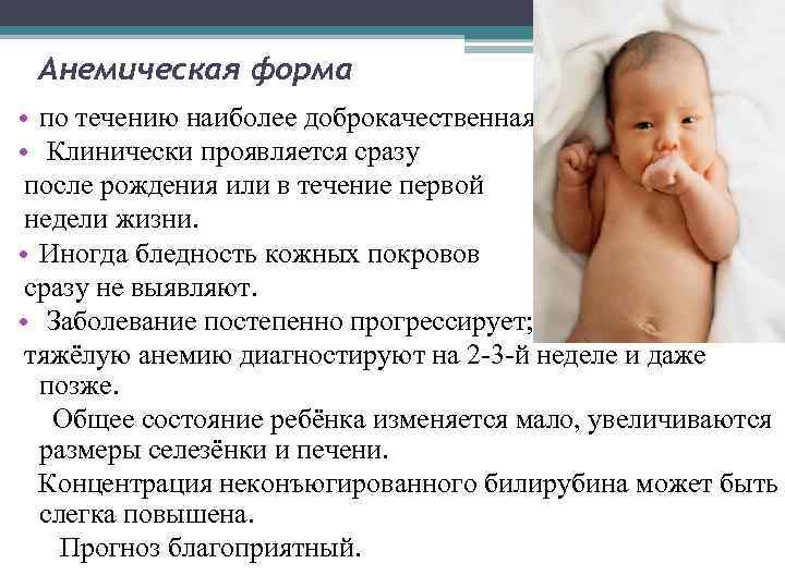 Анемия (низкий гемоглобин) у детей и взрослых - симптомы, степени, причины и лечение - docdoc.ru